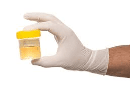urine testing